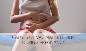 What Are the Causes of Bleeding and Spotting in Pregnancy - Urban Mamaz