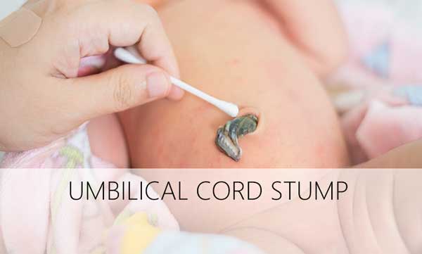 UMBILICAL-CORD-STUMP